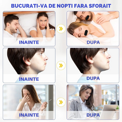 Set 30 Benzi tip Plasture Anti-sforait Binovation®, Material Hipoalergenic, Rezistent la umezeala si confortabil Wanty