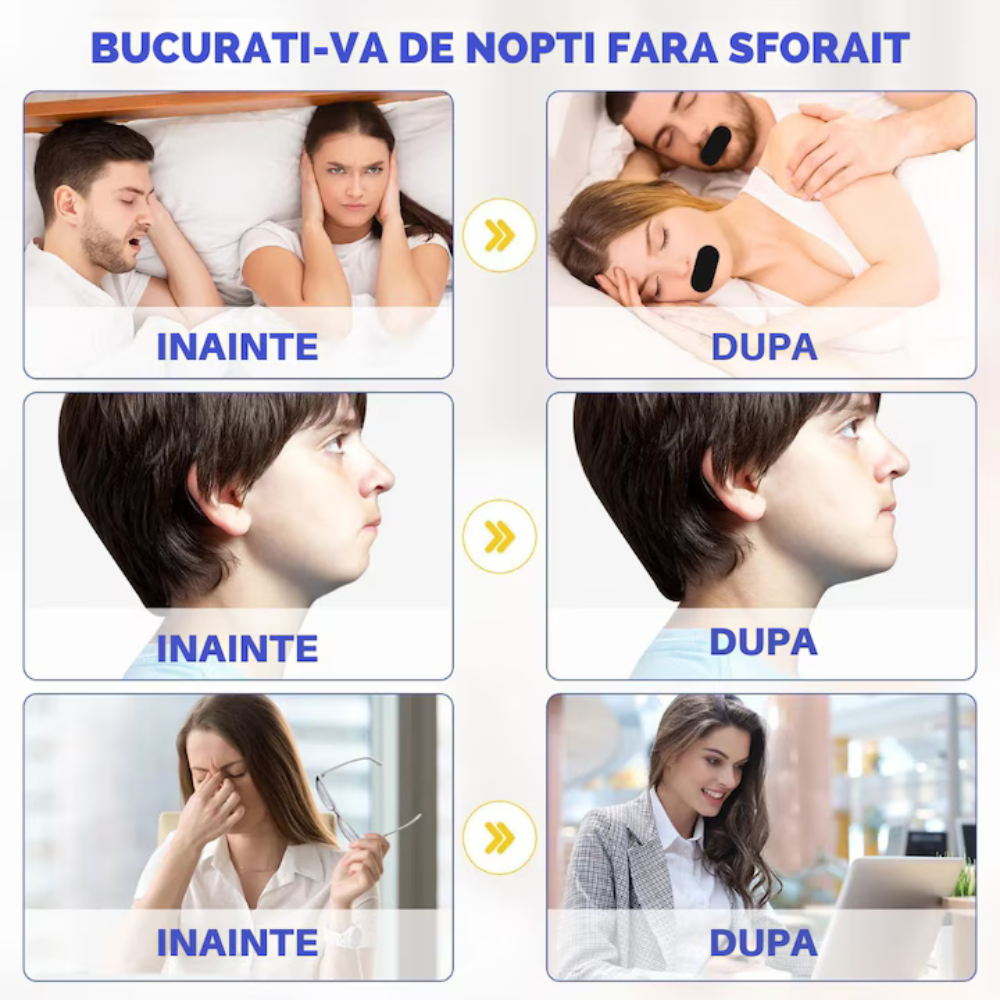 Set 30 Benzi tip Plasture Anti-sforait Binovation®, Material Hipoalergenic, Rezistent la umezeala si confortabil