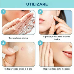 plasturi pentru cosuri mod de utilizare pas cu pas